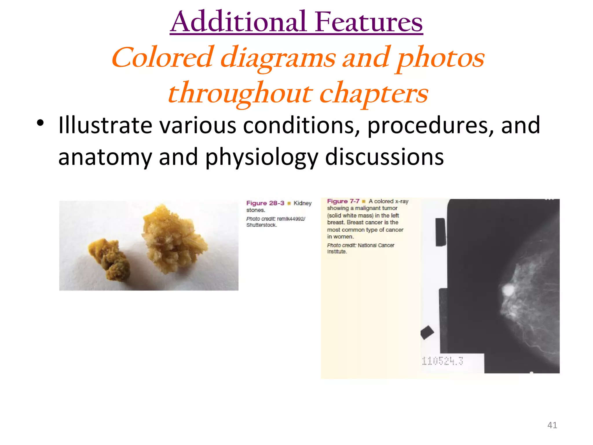 Additional Features
Colored diagrams and photos
throughout chapters

• Illustrate various conditions, procedures, and
anatomy and physiology discussions

41

 
