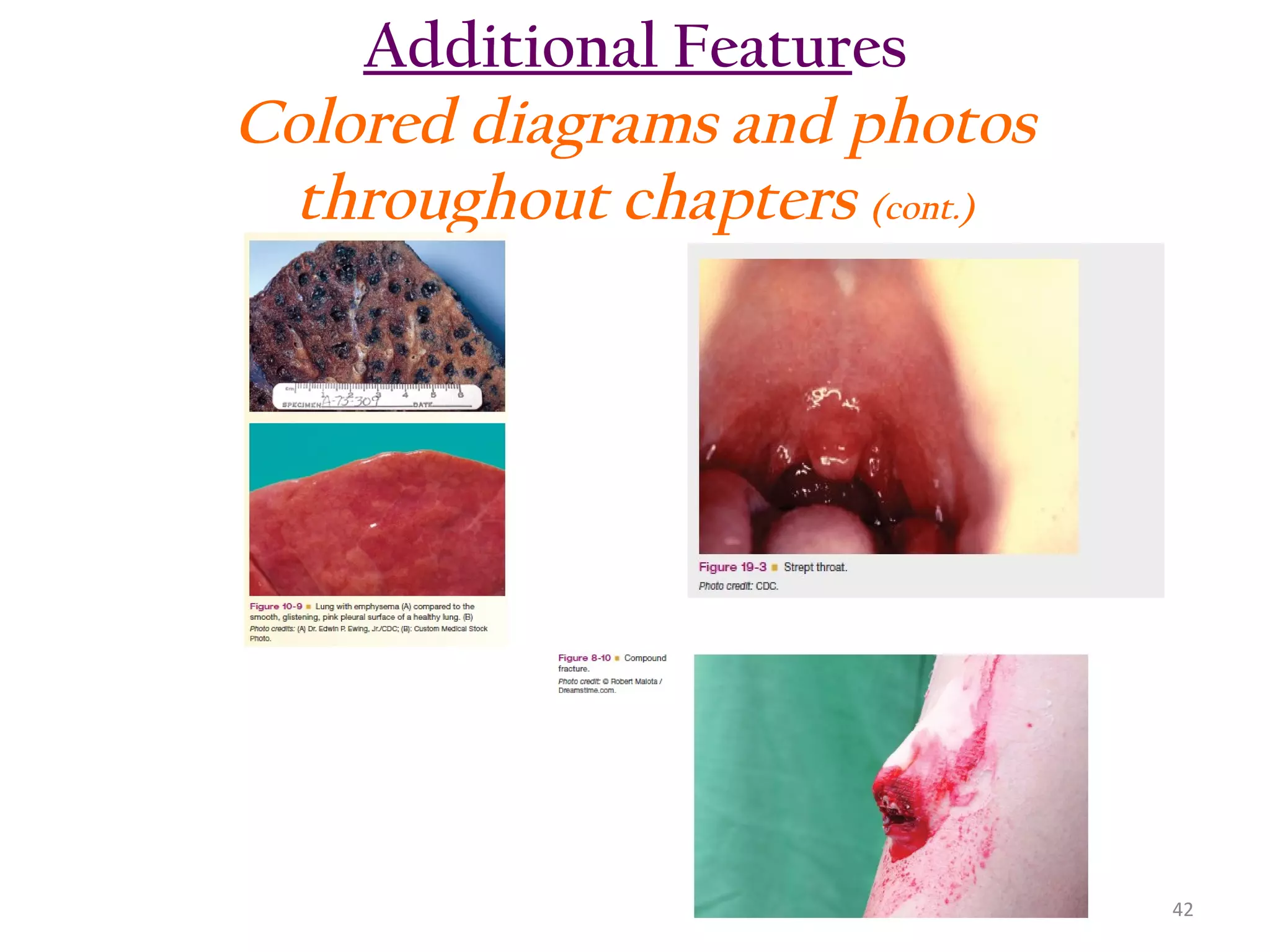 Additional Features
Colored diagrams and photos
throughout chapters (cont.)

42

 