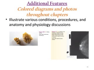 Additional Features
Colored diagrams and photos
throughout chapters

• Illustrate various conditions, procedures, and
anatomy and physiology discussions

41

 