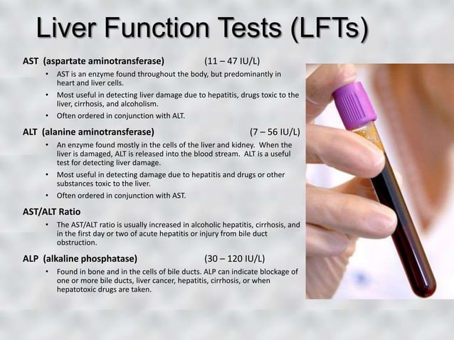 dental-patients-with-liver-disease-ppt