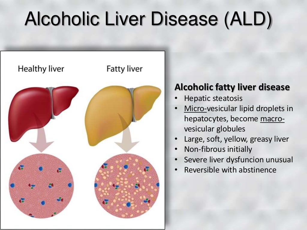Dental Patients with Liver Disease