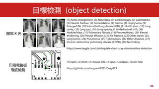 11
Ŀ˙zy (object detection)
(1) open, (2) short, (3) mouse bite, (4) spur, (5) copper, (6) pin hole
https://github.com/tangsanli5201/DeepPCB
ӡˢ·
覴Ùzy
ز X 
(1) Aortic enlargement, (2) Atelectasis, (3) Cardiomegaly, (4) Calcification,
(5) Clavicle fracture, (6) Consolidation, (7) Edema, (8) Emphysema, (9)
Enlarged PA, (10) Interstitial lung disease (ILD), (11) Infiltration, (12) Lung
cavity, (13) Lung cyst, (14) Lung opacity, (15) Mediastinal shift, (16)
Nodule/Mass, (17) Pulmonary fibrosis, (18) Pneumothorax, (19) Pleural
thickening, (20) Pleural effusion, (21) Rib fracture, (22) Other lesion, (23)
Lung tumor, (24) Pneumonia, (25) Tuberculosis, (26) Other diseases, (27)
Chronic obstructive pulmonary disease (COPD), (28) No finding
https://www.kaggle.com/c/vinbigdata-chest-xray-abnormalities-detection
 