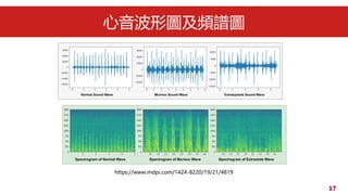17
ΈDlVD
https://www.mdpi.com/1424-8220/19/21/4819
 