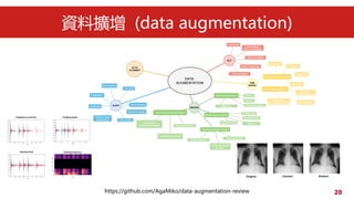 20
YϔU (data augmentation)
https://github.com/AgaMiko/data-augmentation-review
 