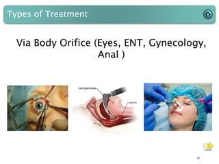 Types of Treatment
10
Via Body Orifice (Eyes, ENT, Gynecology,
Anal )
 