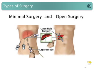Types of Surgery
Minimal Surgery and Open Surgery
11
 