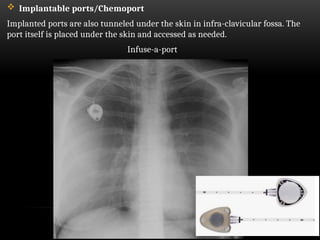 Medical devices of the chest on xray copy.pptx