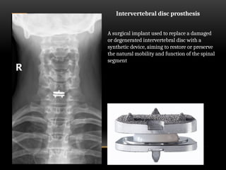 Medical devices of the chest on xray copy.pptx