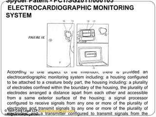 Spyder Patent - PCT/SG2011/000105
ELECTROCARDIOGRAPHIC MONITORING SYSTEM




 According to one aspect of the invention, th...