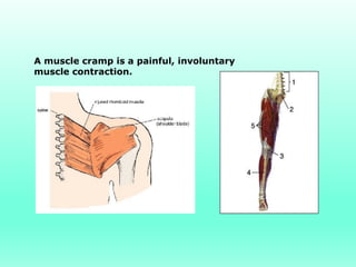 A muscle cramp is a painful, involuntary
muscle contraction.
 