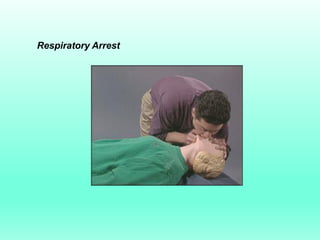 Respiratory Arrest
 