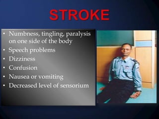 • Numbness, tingling, paralysis
on one side of the body
• Speech problems
• Dizziness
• Confusion
• Nausea or vomiting
• Decreased level of sensorium

 