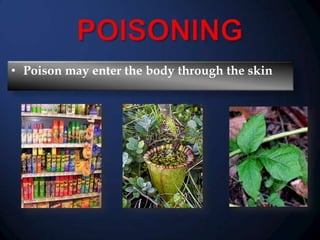 • Poison may enter the body through the skin

 