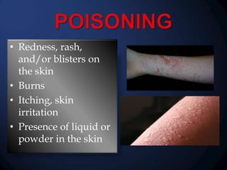 • Redness, rash,
and/or blisters on
the skin
• Burns
• Itching, skin
irritation
• Presence of liquid or
powder in the skin

 