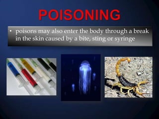 • poisons may also enter the body through a break
in the skin caused by a bite, sting or syringe

 