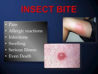 •
•
•
•
•
•

Pain
Allergic reactions
Infections
Swelling
Serious Illness
Even Death

 