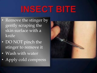 • Remove the stinger by
gently scraping the
skin surface with a
knife
• DO NOT pinch the
stinger to remove it
• Wash with water
• Apply cold compress

 