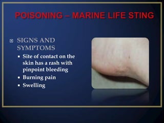 

SIGNS AND
SYMPTOMS





Site of contact on the
skin has a rash with
pinpoint bleeding
Burning pain
Swelling

 