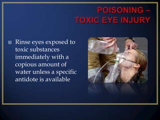 

Rinse eyes exposed to
toxic substances
immediately with a
copious amount of
water unless a specific
antidote is available

 