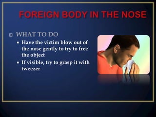 

WHAT TO DO




Have the victim blow out of
the nose gently to try to free
the object
If visible, try to grasp it with
tweezer

 