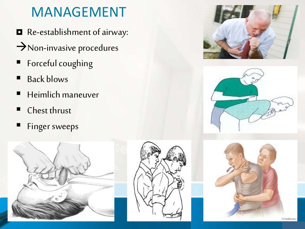 Medical emergencies in Dental office