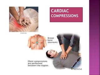Medical emergencies in pediatric dental practice | PPTX