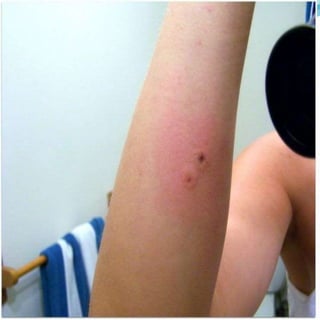 Medical Emergency On Scorpion Sting New 4