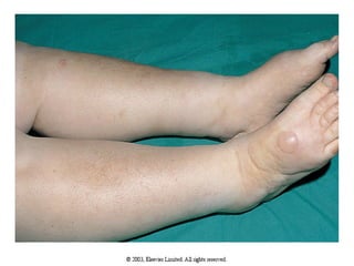 Medical Encyclopedia