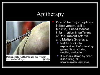 Apitherapy
 One of the major peptides
in bee venom, called
Melittin, is used to treat
inflammation in sufferers
of Rheumatoid Arthritis
and Multiple Sclerosis.
 Melittin blocks the
expression of inflammatory
genes, thus reducing
swelling and pain.
 It is administered by direct
insect sting, or
intramuscular injections.
 