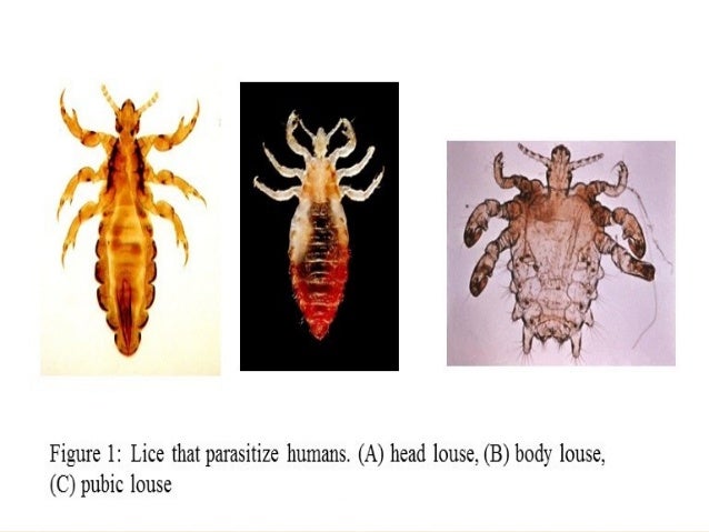 Lice Flea