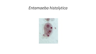 Entamaeba histolytica
 