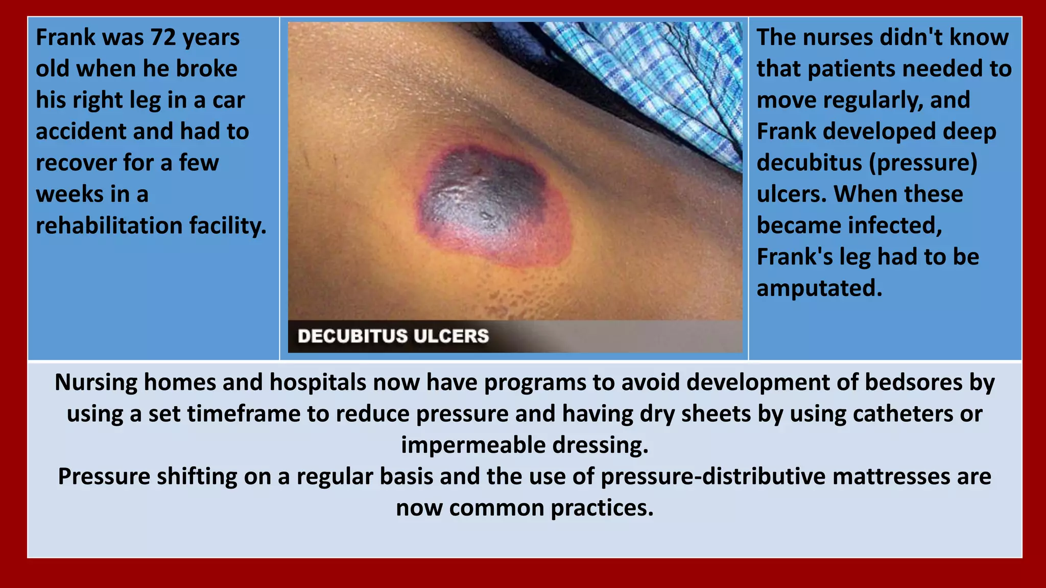 The nurses didn't know
that patients needed to
move regularly, and
Frank developed deep
decubitus (pressure)
ulcers. When these
became infected,
Frank's leg had to be
amputated.
Frank was 72 years
old when he broke
his right leg in a car
accident and had to
recover for a few
weeks in a
rehabilitation facility.
Nursing homes and hospitals now have programs to avoid development of bedsores by
using a set timeframe to reduce pressure and having dry sheets by using catheters or
impermeable dressing.
Pressure shifting on a regular basis and the use of pressure-distributive mattresses are
now common practices.
 
