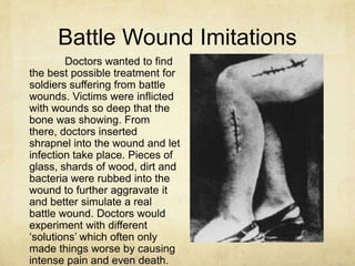 Battle Wound Imitations
        Doctors wanted to find
the best possible treatment for
soldiers suffering from battle
wounds. Victims were inflicted
with wounds so deep that the
bone was showing. From
there, doctors inserted
shrapnel into the wound and let
infection take place. Pieces of
glass, shards of wood, dirt and
bacteria were rubbed into the
wound to further aggravate it
and better simulate a real
battle wound. Doctors would
experiment with different
„solutions‟ which often only
made things worse by causing
intense pain and even death.
 