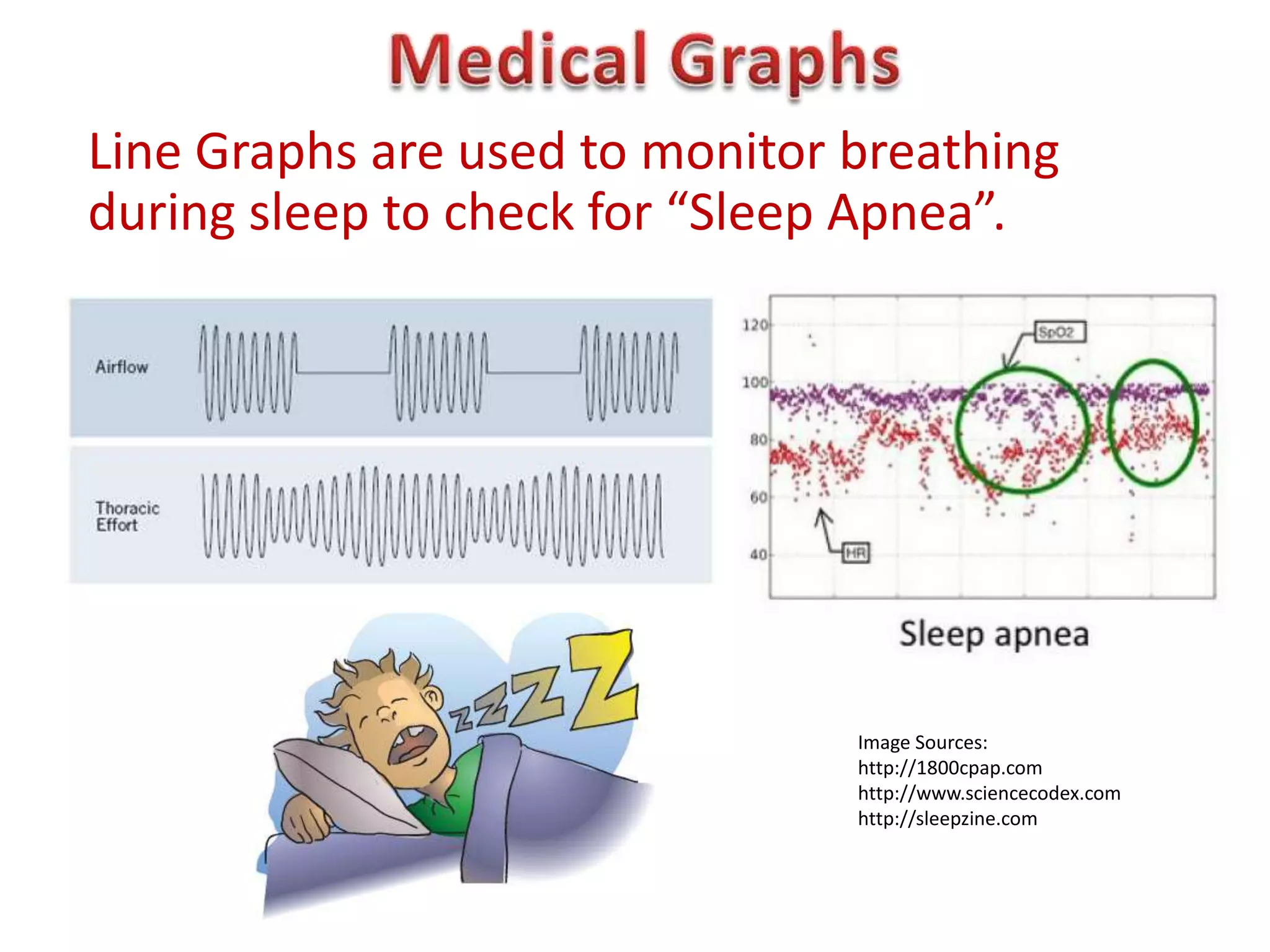 Line Graphs are used to monitor breathing
during sleep to check for “Sleep Apnea”.




                                Image Sources:
                                http://1800cpap.com
                                http://www.sciencecodex.com
                                http://sleepzine.com
 