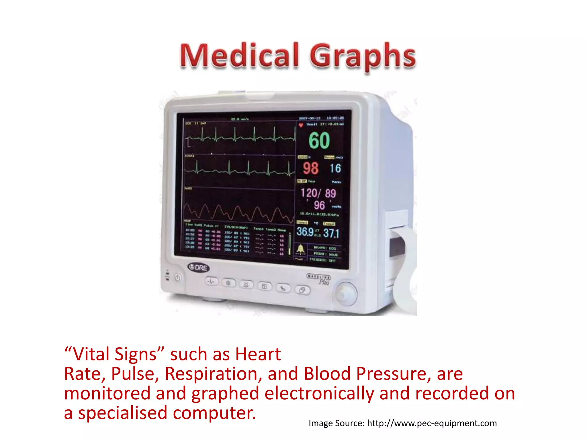 “Vital Signs” such as Heart
Rate, Pulse, Respiration, and Blood Pressure, are
monitored and graphed electronically and recorded on
a specialised computer.       Image Source: http://www.pec-equipment.com
 