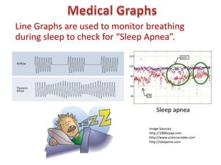 Line Graphs are used to monitor breathing
during sleep to check for “Sleep Apnea”.




                                Image Sources:
                                http://1800cpap.com
                                http://www.sciencecodex.com
                                http://sleepzine.com
 