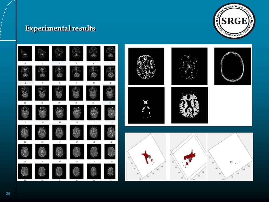 Medical image analysis