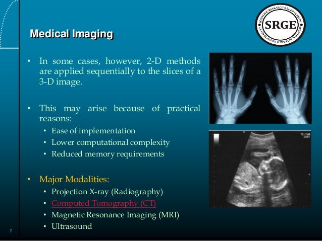 thesis on medical image processing thesis on medical image processing
