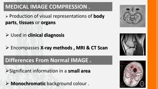 Medical image compression | PPTX
