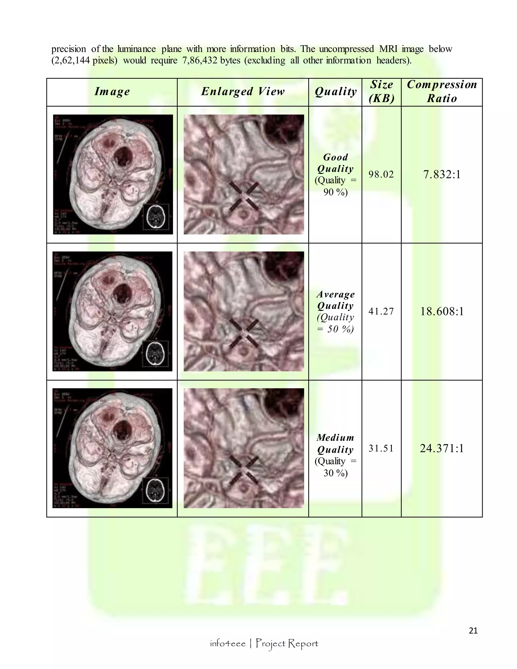 21 
precision of the luminance plane with more information bits. The uncompressed MRI image below 
(2,62,144 pixels) would require 7,86,432 bytes (excluding all other information headers). 
Image Enlarged View Qual i ty 
info4eee | Project Report 
Size 
(KB) 
Compression 
Ratio 
Good 
Qual i ty 
(Quality = 
90 %) 
98.02 7.832:1 
Average 
Qual i ty 
(Quality 
= 50 %) 
41.27 18.608:1 
Medium 
Qual i ty 
(Quality = 
30 %) 
31.51 24.371:1 
 