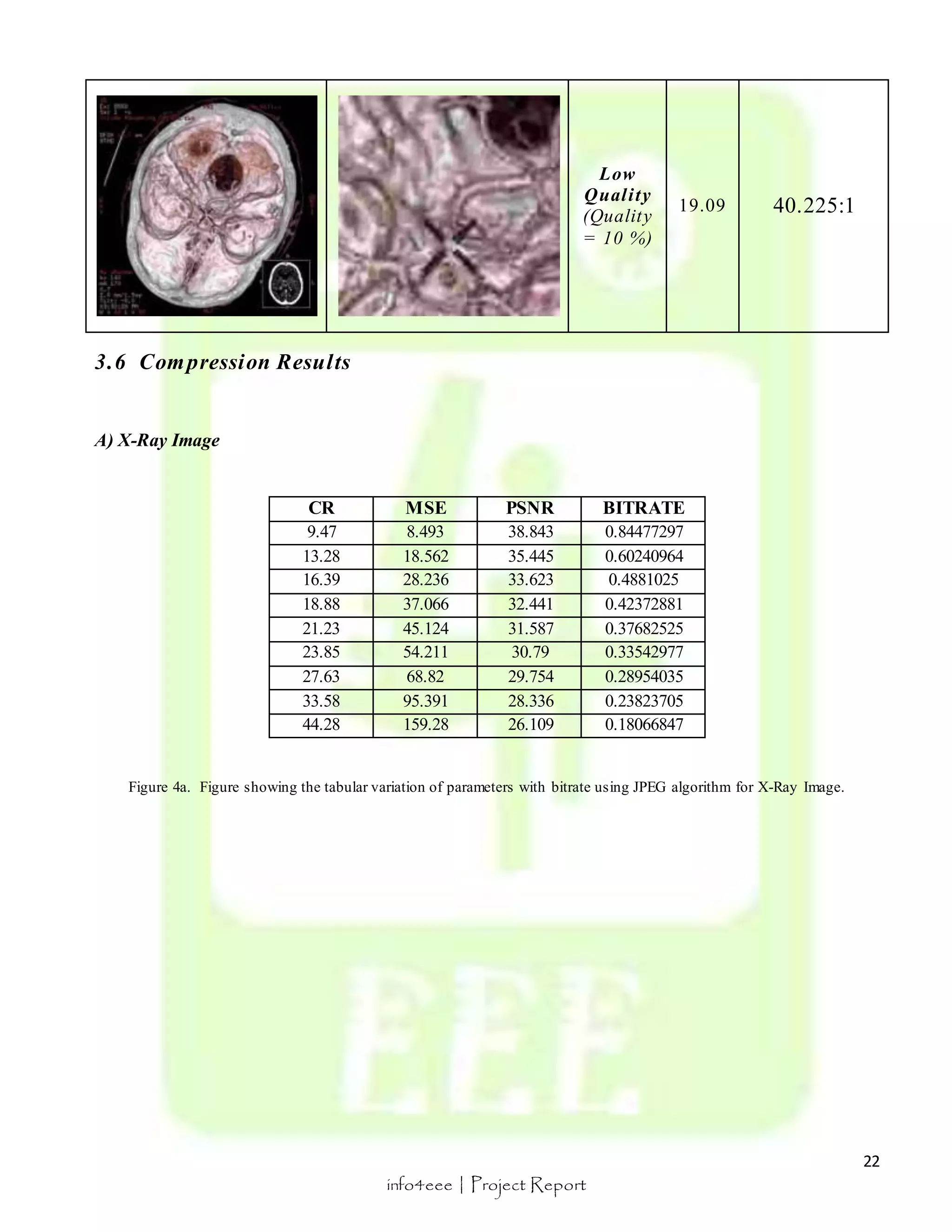 22 
Low 
Qual i ty 
(Quality 
= 10 %) 
info4eee | Project Report 
19.09 40.225:1 
3.6 Compression Resul ts 
A) X-Ray Image 
CR MSE PSNR BITRATE 
9.47 8.493 38.843 0.84477297 
13.28 18.562 35.445 0.60240964 
16.39 28.236 33.623 0.4881025 
18.88 37.066 32.441 0.42372881 
21.23 45.124 31.587 0.37682525 
23.85 54.211 30.79 0.33542977 
27.63 68.82 29.754 0.28954035 
33.58 95.391 28.336 0.23823705 
44.28 159.28 26.109 0.18066847 
Figure 4a. Figure showing the tabular variation of parameters with bitrate using JPEG algorithm for X-Ray Image. 
 