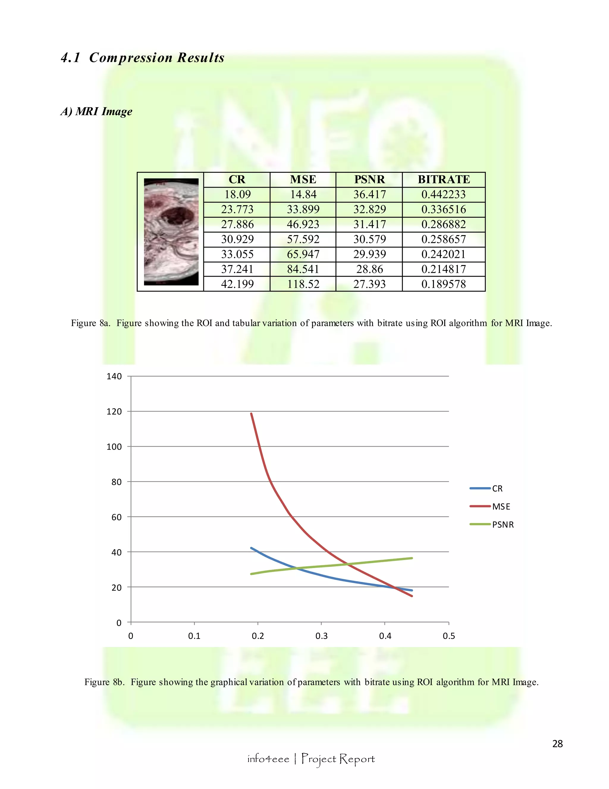 28 
0 0.1 0.2 0.3 0.4 0.5 
info4eee | Project Report 
4.1 Compression Resul ts 
A) MRI Image 
CR MSE PSNR BITRATE 
18.09 14.84 36.417 0.442233 
23.773 33.899 32.829 0.336516 
27.886 46.923 31.417 0.286882 
30.929 57.592 30.579 0.258657 
33.055 65.947 29.939 0.242021 
37.241 84.541 28.86 0.214817 
42.199 118.52 27.393 0.189578 
Figure 8a. Figure showing the ROI and tabular variation of parameters with bitrate using ROI algorithm for MRI Image. 
140 
120 
100 
80 
60 
40 
20 
0 
CR 
MSE 
PSNR 
Figure 8b. Figure showing the graphical variation of parameters with bitrate using ROI algorithm for MRI Image. 
 