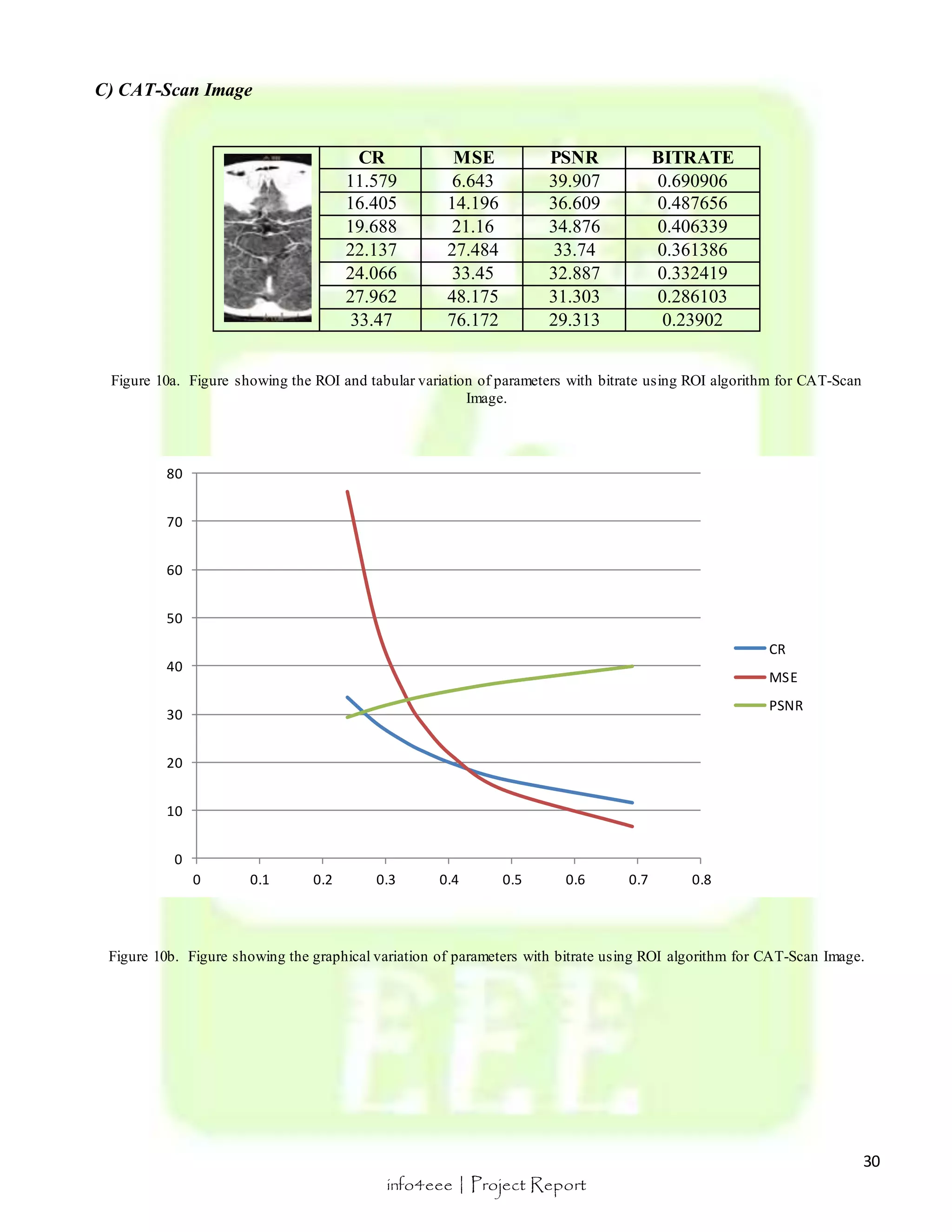 30 
0 0.1 0.2 0.3 0.4 0.5 0.6 0.7 0.8 
info4eee | Project Report 
C) CAT-Scan Image 
CR MSE PSNR BITRATE 
11.579 6.643 39.907 0.690906 
16.405 14.196 36.609 0.487656 
19.688 21.16 34.876 0.406339 
22.137 27.484 33.74 0.361386 
24.066 33.45 32.887 0.332419 
27.962 48.175 31.303 0.286103 
33.47 76.172 29.313 0.23902 
Figure 10a. Figure showing the ROI and tabular variation of parameters with bitrate using ROI algorithm for CAT-Scan 
Image. 
80 
70 
60 
50 
40 
30 
20 
10 
0 
CR 
MSE 
PSNR 
Figure 10b. Figure showing the graphical variation of parameters with bitrate using ROI algorithm for CAT-Scan Image. 
 