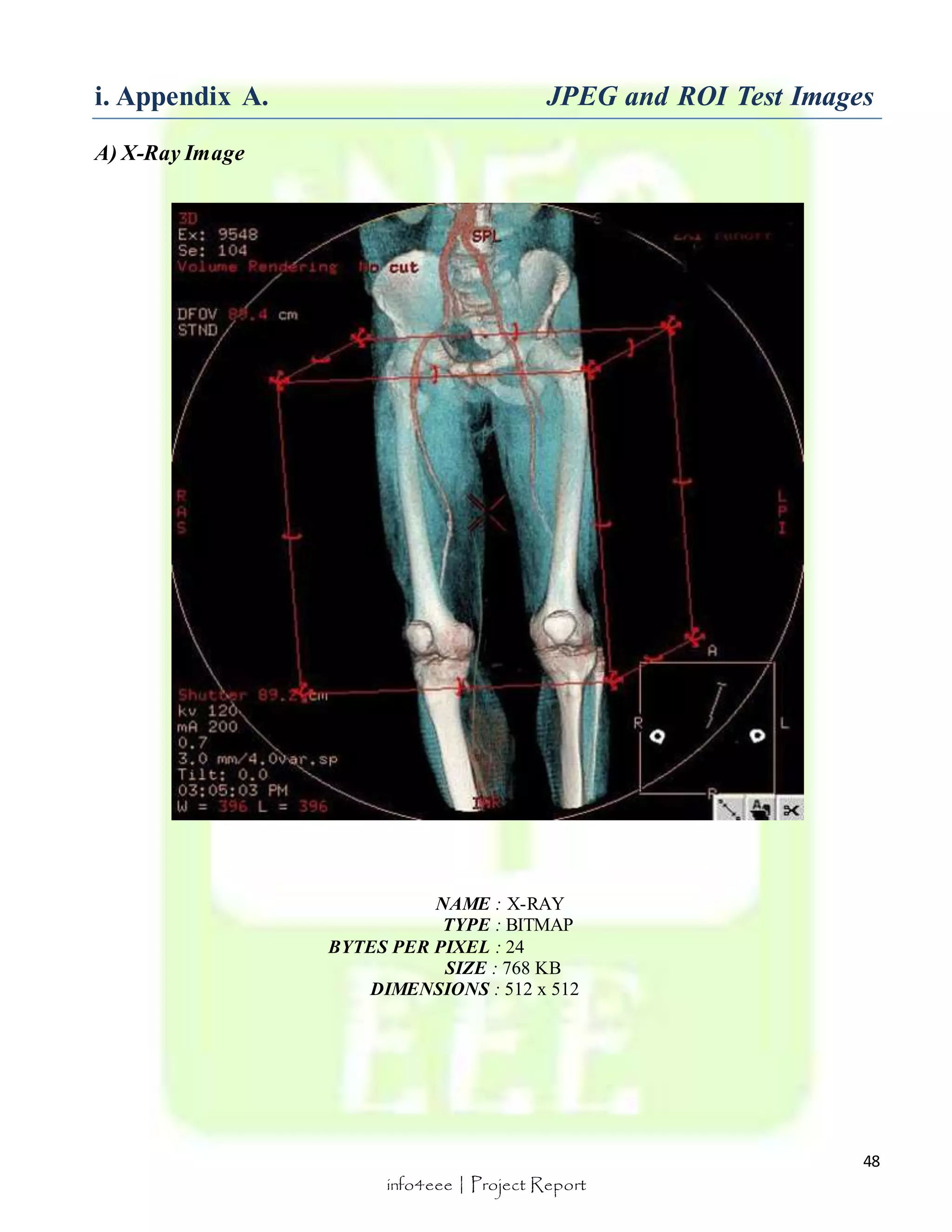 i. Appendix A. JPEG and ROI Test Images 
48 
info4eee | Project Report 
A) X-Ray Image 
NAME : X-RAY 
TYPE : BITMAP 
BYTES PER PIXEL : 24 
SIZE : 768 KB 
DIMENSIONS : 512 x 512 
 