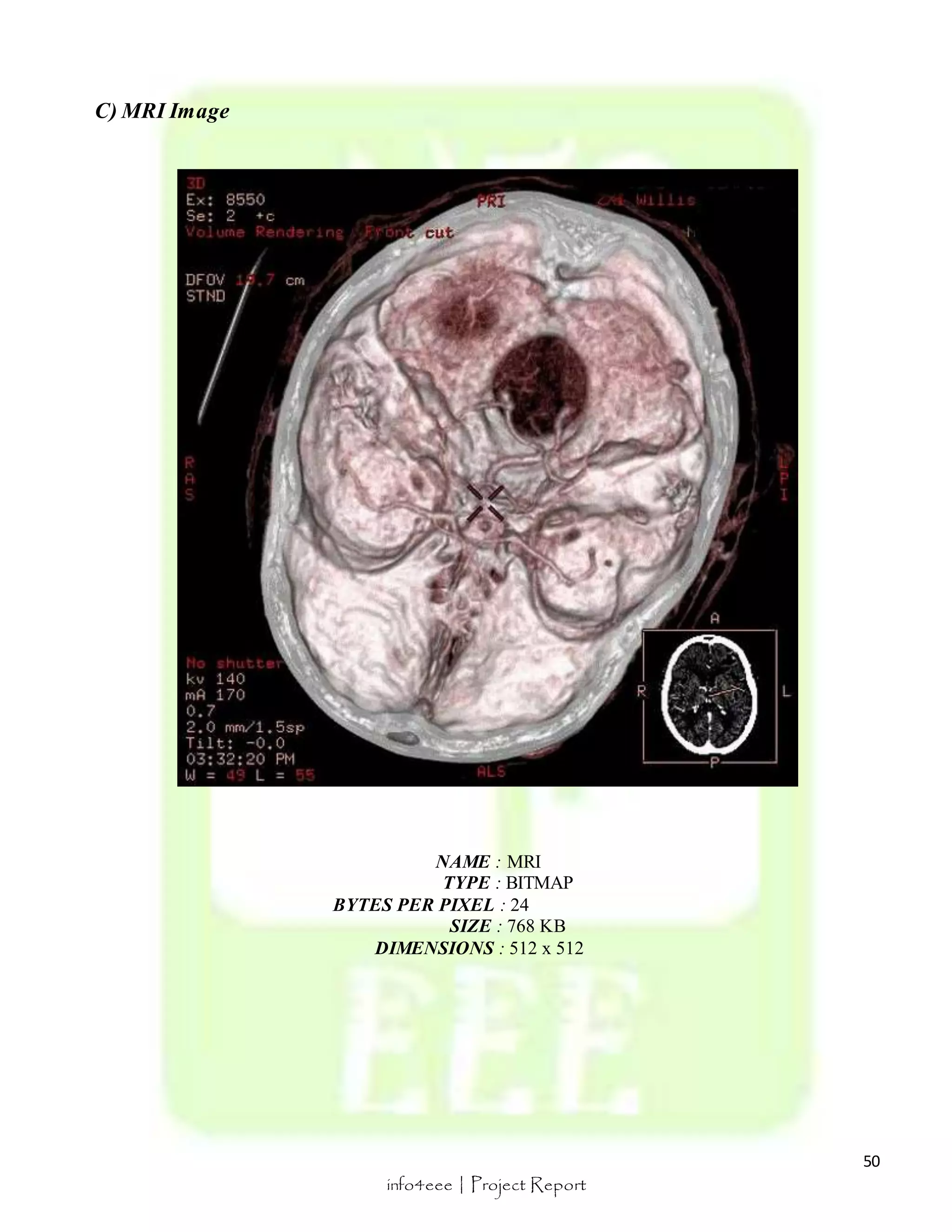 50 
info4eee | Project Report 
C) MRI Image 
NAME : MRI 
TYPE : BITMAP 
BYTES PER PIXEL : 24 
SIZE : 768 KB 
DIMENSIONS : 512 x 512 
 