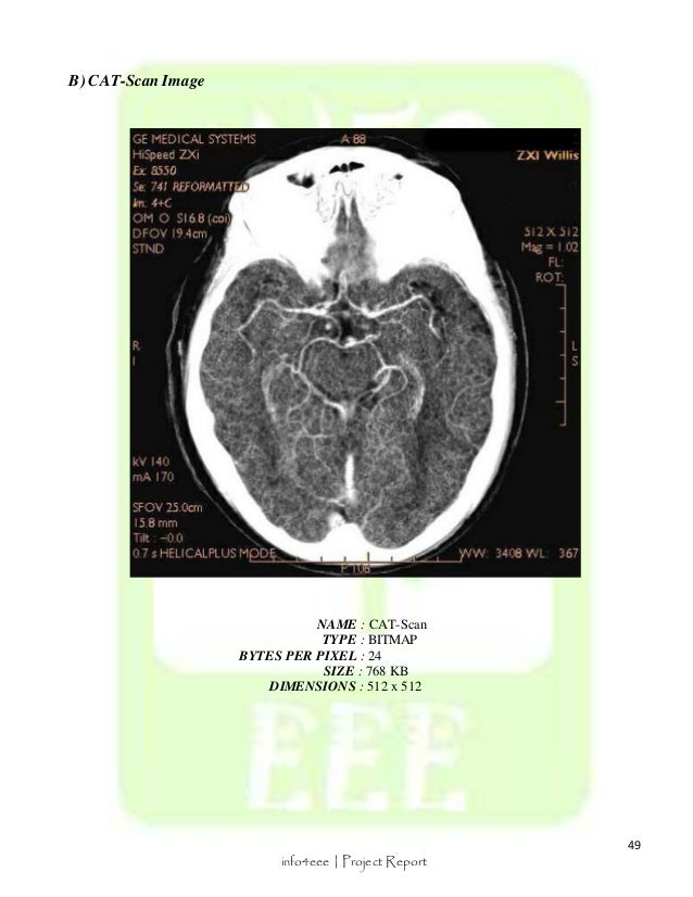 Medical Image Compression Project Report - mri scan machine