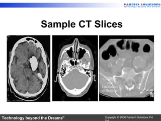 Medical Image Processing | PPT