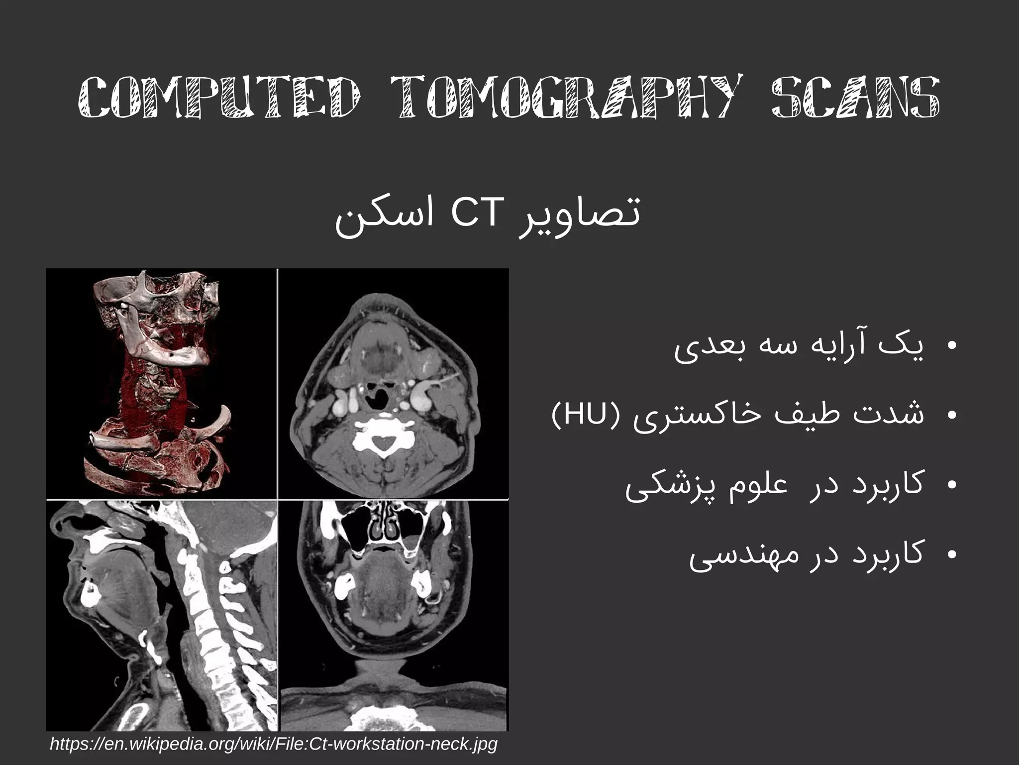 COMPUTED TOMOGRAPHY SCANS
‫تصاویر‬CT‫اسکن‬
●‫بعدی‬ ‫سه‬ ‫آرایه‬ ‫یک‬
●) ‫خاکستری‬ ‫طیف‬ ‫شدت‬HU(
●‫پزشکی‬ ‫علوم‬ ‫در‬ ‫کاربرد‬
●‫مهندسی‬ ‫در‬ ‫کاربرد‬
https://en.wikipedia.org/wiki/File:Ct-workstation-neck.jpg
 