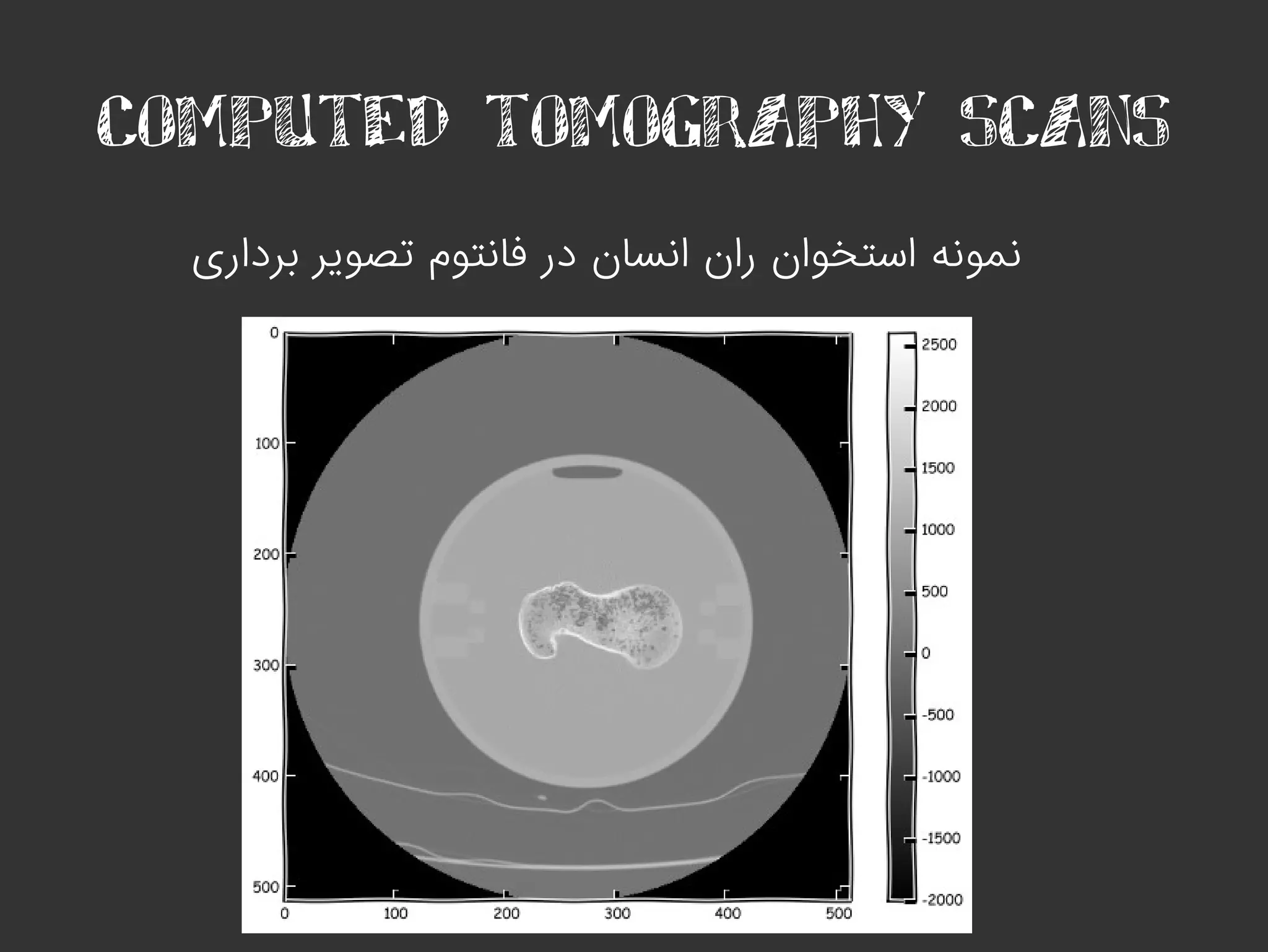 COMPUTED TOMOGRAPHY SCANS
‫برداری‬ ‫تصویر‬ ‫فانتوم‬ ‫در‬ ‫انسان‬ ‫ران‬ ‫استخوان‬ ‫نمونه‬
 