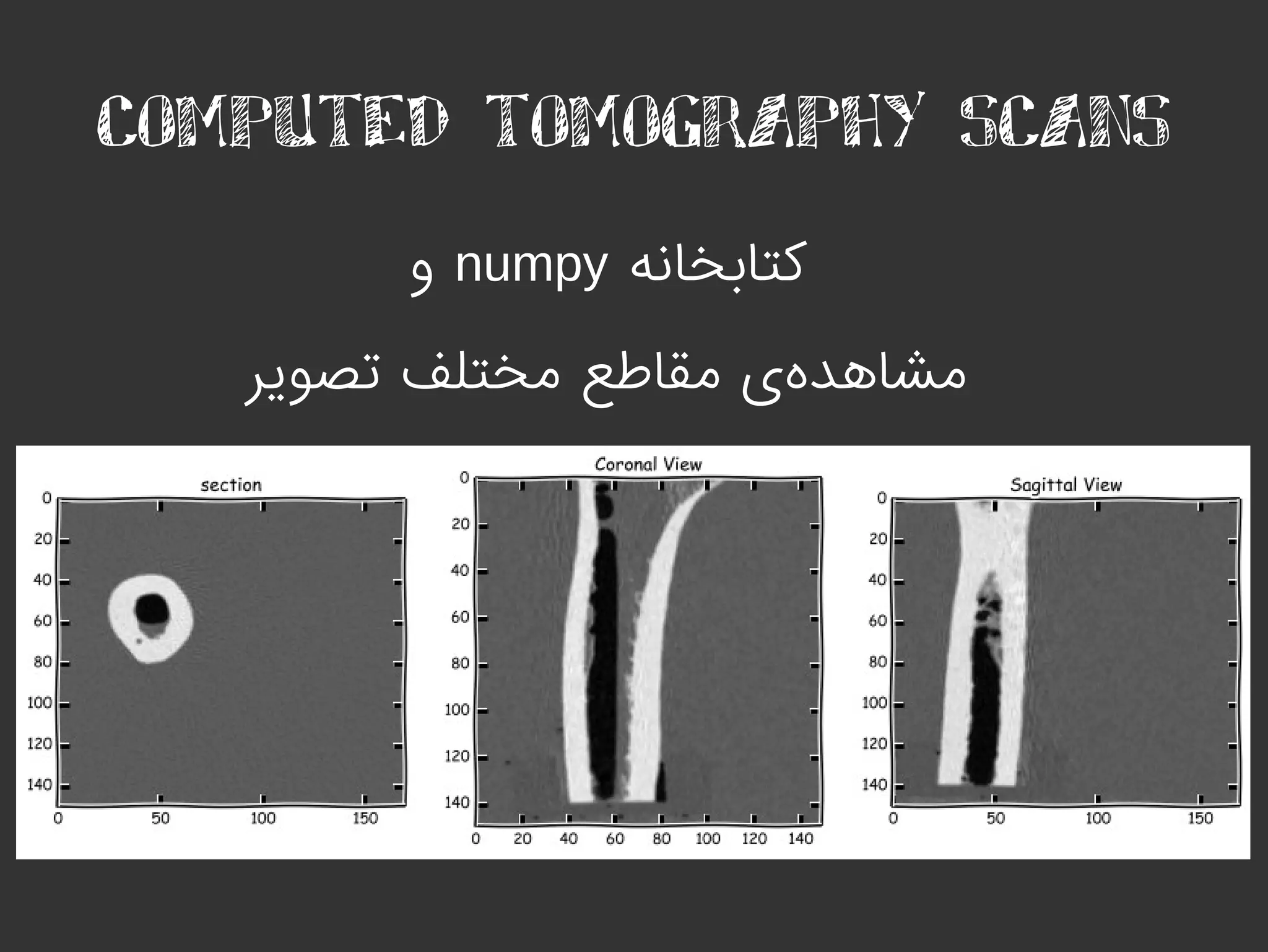 COMPUTED TOMOGRAPHY SCANS
‫کتابخانه‬numpy‫و‬
‫تصویر‬ ‫مختلف‬ ‫مقاطع‬ ‫ی‬‫مشاهده‬
 